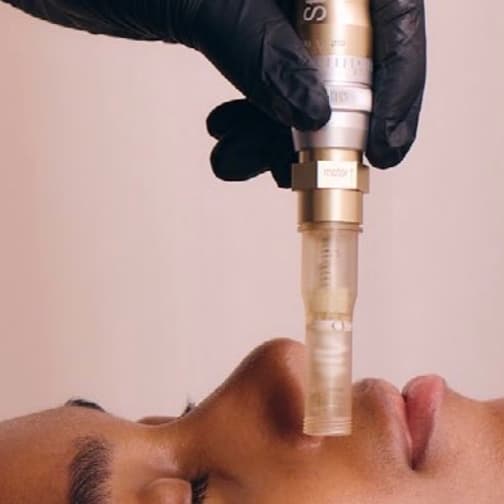 Microneedling Series of 3 at SKINJEVITY BY DARA in Castle Rock, CO